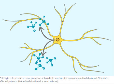 neuroalz