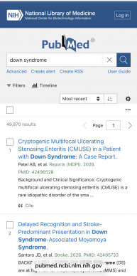 down syndrome - Search Results - PubMed